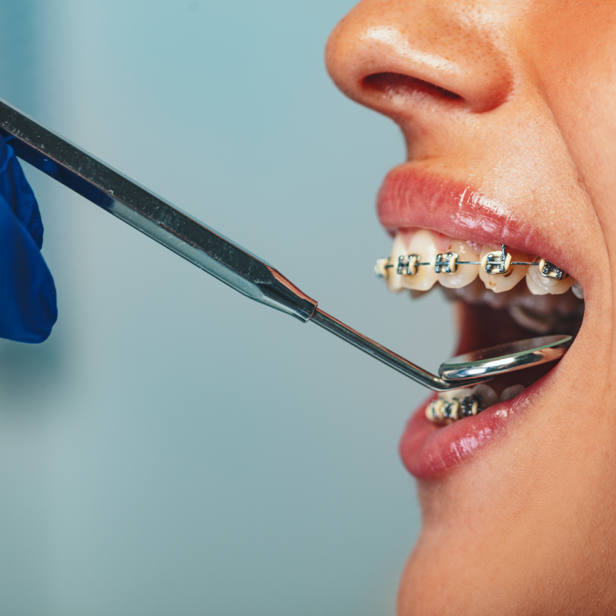 checking-braces-2024-10-18-16-00-20-utc