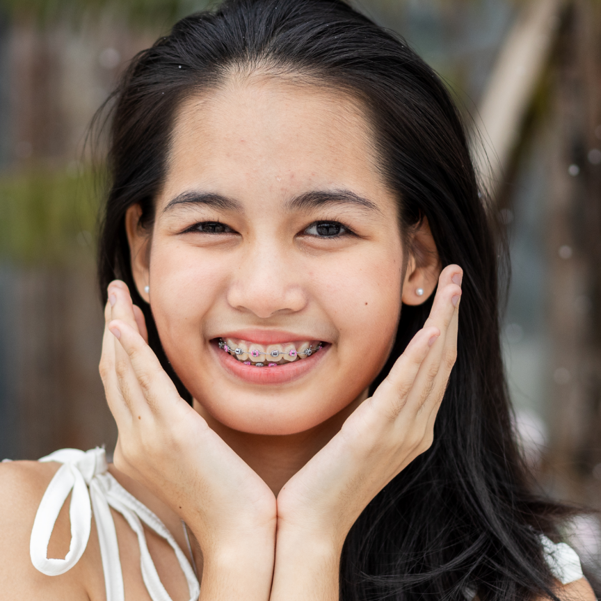 young-female-beautiful-smile-with-braces-close-up-2025-03-05-22-04-38-utc
